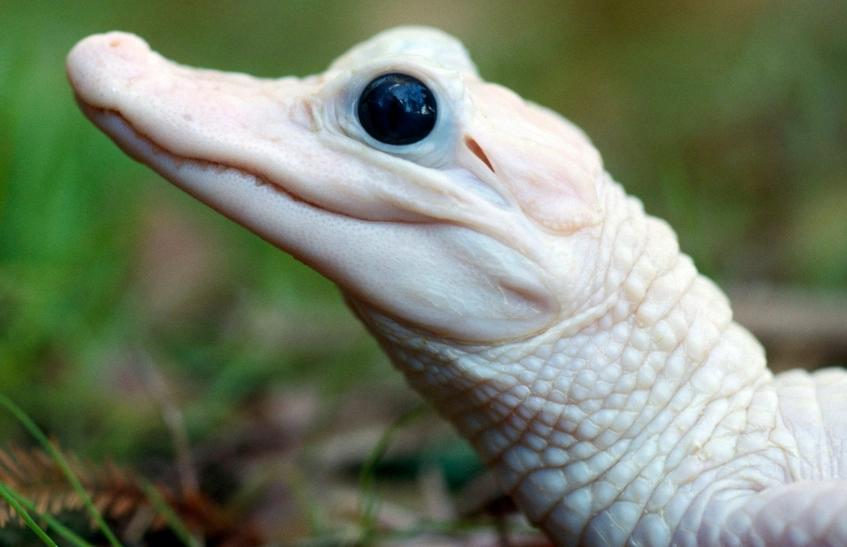 albinism vision problems