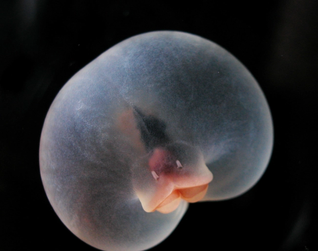 how to get rid of pigbut worms